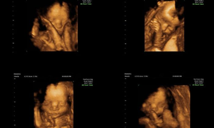 3d ultrasounds reno baby picture sessions tummy capture offering moments office special now